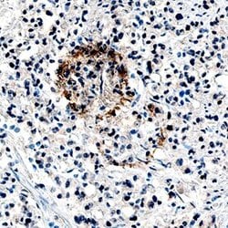 Invitrogen Angiopoietin 1 Monoclonal Antibody (171718) 100 &mu;g; Unconjugated:Antibodies,