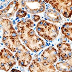 Cathepsin L Monoclonal Antibody (204101), Invitrogen 100 &mu;g; Unconjugated:Antibodies,
