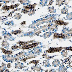 Cathepsin L Monoclonal Antibody (204101), Invitrogen 100 &mu;g; Unconjugated:Antibodies,