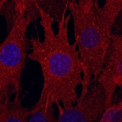 Invitrogen CD105 Monoclonal Antibody (209701) 100 &mu;g; Unconjugated:Antibodies,