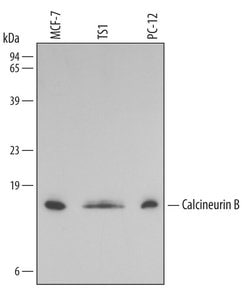 Invitrogen Calcineurin B Monoclonal Antibody (212306) 100 &mu;g; Unconjugated:Antibodies,