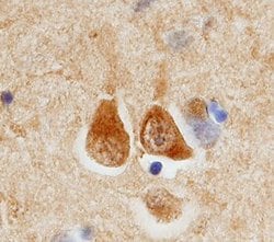 Invitrogen ECE2 Monoclonal Antibody (233914) 100 &mu;g; Unconjugated:Antibodies,