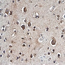 Invitrogen PTPRZ Monoclonal Antibody (279245) 100 &mu;g; Unconjugated:Antibodies,