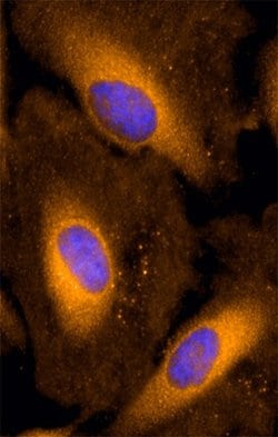 Invitrogen SLC27A1 Monoclonal Antibody (308420) 100 &mu;g; Unconjugated:Antibodies,