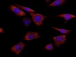 Invitrogen S100A8 Monoclonal Antibody (335806) 100 &mu;g; Unconjugated:Antibodies,