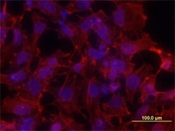 Invitrogen S100P Monoclonal Antibody (357517) 100 &mu;g; Unconjugated:Antibodies,