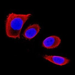 Invitrogen Chondrolectin Monoclonal Antibody (396305) 100 &mu;g; Unconjugated:Antibodies,