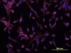 Invitrogen DSCAM Monoclonal Antibody (399212) 100 &mu;g; Unconjugated:Antibodies,