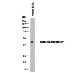 Invitrogen Carbonic Anhydrase VI Monoclonal Antibody (401819) 100 &mu;g;