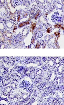 Invitrogen PRSS3 Monoclonal Antibody (419911) 100 &mu;g; Unconjugated:Antibodies,