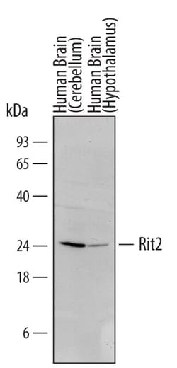 Invitrogen RIT2 Monoclonal Antibody (456313) 100 &mu;g | Buy Online | Invitrogen&trade; | Fisher Scientific