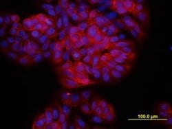 Invitrogen TSPAN8 Monoclonal Antibody (458811) 100 &mu;g; Unconjugated:Antibodies,