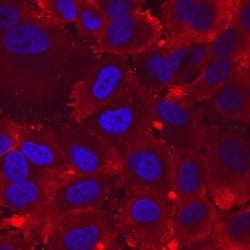 ITGA8 Monoclonal Antibody (481709):Antibodies, Monoclonal