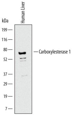Invitrogen CES1 Monoclonal Antibody (544623) 100 &mu;g; Unconjugated:Antibodies,