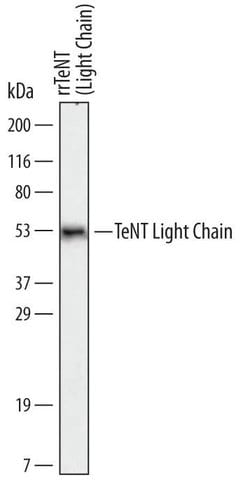 Invitrogen C. tetani TeNT Light Chain Monoclonal Antibody (604023) 100