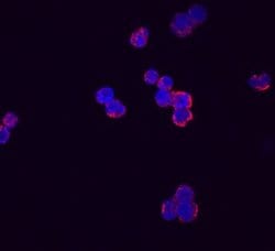 Invitrogen RARRES3 Monoclonal Antibody (659209) 100 &mu;g; Unconjugated:Antibodies,