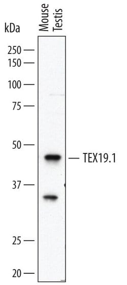 Invitrogen Tex19.1 Monoclonal Antibody (678826) 100 &mu;g; Unconjugated:Antibodies,