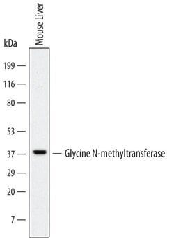 Invitrogen GNMT Monoclonal Antibody (691305) 100 &mu;g | Buy Online | Invitrogen&trade; | Fisher Scientific