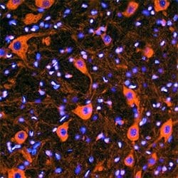 Invitrogen VAPB Monoclonal Antibody (699811) 100 &mu;g; Unconjugated:Antibodies,