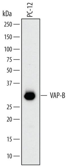 Invitrogen VAPB Monoclonal Antibody (699811) 100 &mu;g; Unconjugated:Antibodies,