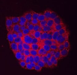 Invitrogen Arylsulfatase B Monoclonal Antibody (708401) 100 &mu;g | Buy Online | Invitrogen&trade; | Fisher Scientific