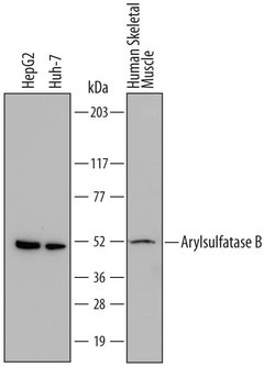 Invitrogen Arylsulfatase B Monoclonal Antibody (708401) 100 &mu;g | Buy Online | Invitrogen&trade; | Fisher Scientific