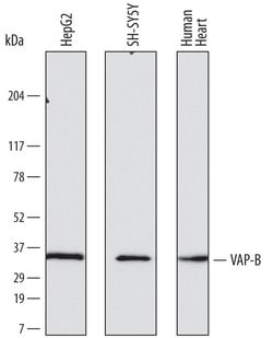 Invitrogen VAPB Monoclonal Antibody (736904) 100 &mu;g; Unconjugated:Antibodies,