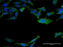 Invitrogen Calmodulin 3 Monoclonal Antibody (1E2) 100 &mu;g; Unconjugated:Antibodies,