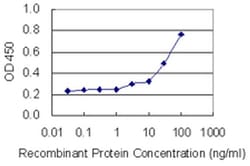 Invitrogen Fibrillin 2 Monoclonal Antibody (1C2) 100 &mu;g; Unconjugated:Antibodies,