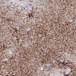 Invitrogen Aquaporin 4 Monoclonal Antibody (CL0178) 100 &mu;L; Unconjugated:Antibodies,