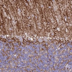 Invitrogen Aquaporin 4 Monoclonal Antibody (CL0178) 100 &mu;L; Unconjugated:Antibodies,