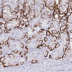Invitrogen Aquaporin 4 Monoclonal Antibody (CL0178) 100 &mu;L; Unconjugated:Antibodies,