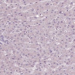 Invitrogen RNASE7 Monoclonal Antibody (CL0223) 100 &mu;L; Unconjugated:Antibodies,