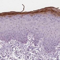 Invitrogen RNASE7 Monoclonal Antibody (CL0223) 100 &mu;L; Unconjugated:Antibodies,