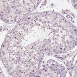 Invitrogen RNASE7 Monoclonal Antibody (CL0223) 100 &mu;L; Unconjugated:Antibodies,