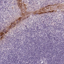 Invitrogen RNASE7 Monoclonal Antibody (CL0223) 100 &mu;L; Unconjugated:Antibodies,
