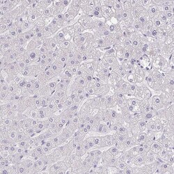 Invitrogen RNASE7 Monoclonal Antibody (CL0224) 100 &mu;L; Unconjugated:Antibodies,