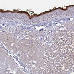 Invitrogen RNASE7 Monoclonal Antibody (CL0224) 100 &mu;L; Unconjugated:Antibodies,