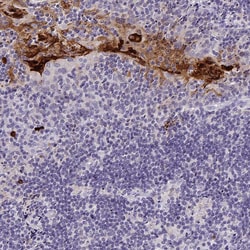 Invitrogen RNASE7 Monoclonal Antibody (CL0224) 100 &mu;L; Unconjugated:Antibodies,
