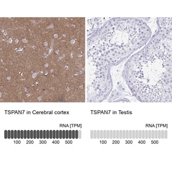 Invitrogen TSPAN7 Monoclonal Antibody (CL0262) 100 &mu;L; Unconjugated:Antibodies,