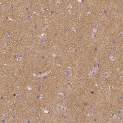 Invitrogen TSPAN7 Monoclonal Antibody (CL0265) 100 &mu;L; Unconjugated:Antibodies,