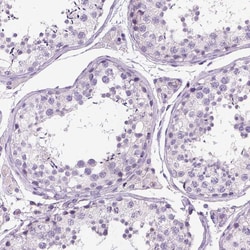 Invitrogen TSPAN7 Monoclonal Antibody (CL0265) 100 &mu;L; Unconjugated:Antibodies,