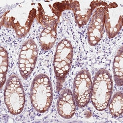 Invitrogen ACSL5 Monoclonal Antibody (CL0275) 100 &mu;L; Unconjugated:Antibodies,