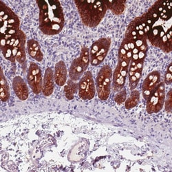 Invitrogen ACSL5 Monoclonal Antibody (CL0275) 100 &mu;L; Unconjugated:Antibodies,