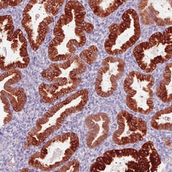 Invitrogen ACSL5 Monoclonal Antibody (CL0275) 100 &mu;L; Unconjugated:Antibodies,