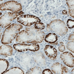 Invitrogen Carbonic Anhydrase XII Monoclonal Antibody (CL0278) 100 &mu;L;