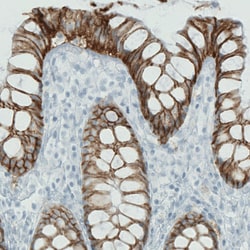 Invitrogen Carbonic Anhydrase XII Monoclonal Antibody (CL0278) 100 &mu;L;