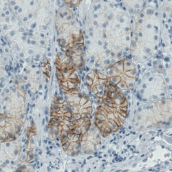 Invitrogen Carbonic Anhydrase XII Monoclonal Antibody (CL0278) 100 &mu;L;