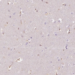Invitrogen NAPRT1 Monoclonal Antibody (CL0366) 100 &mu;L; Unconjugated:Antibodies,