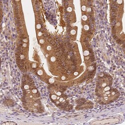Invitrogen NAPRT1 Monoclonal Antibody (CL0366) 100 &mu;L; Unconjugated:Antibodies,
